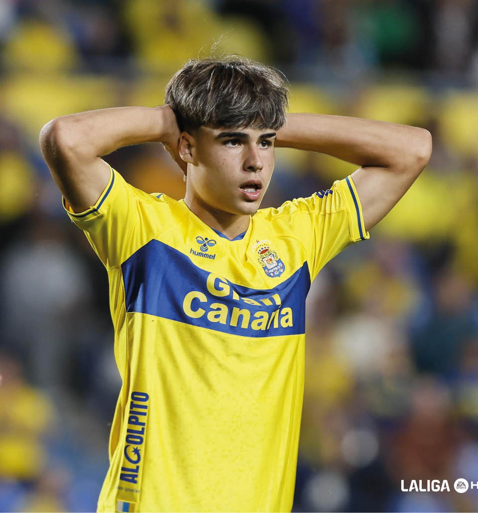 Persona con camiseta amarilla de un equipo de f tbol con las manos en la cabeza mostrando una expresi n de sorpresa o frustraci n durante un partido. Descripci n generada con IA